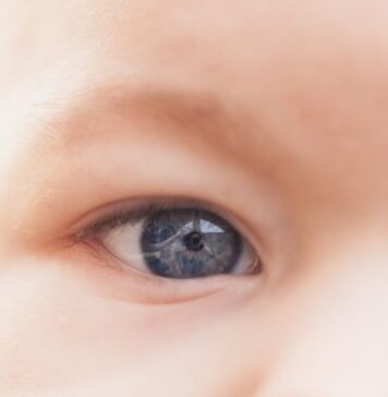 movimiento ocular, nistagmo, Pompe infantil