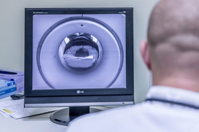 ¿Podrían los ultrasonidos acelerar el diagnóstico de la enfermedad de Fabry?
